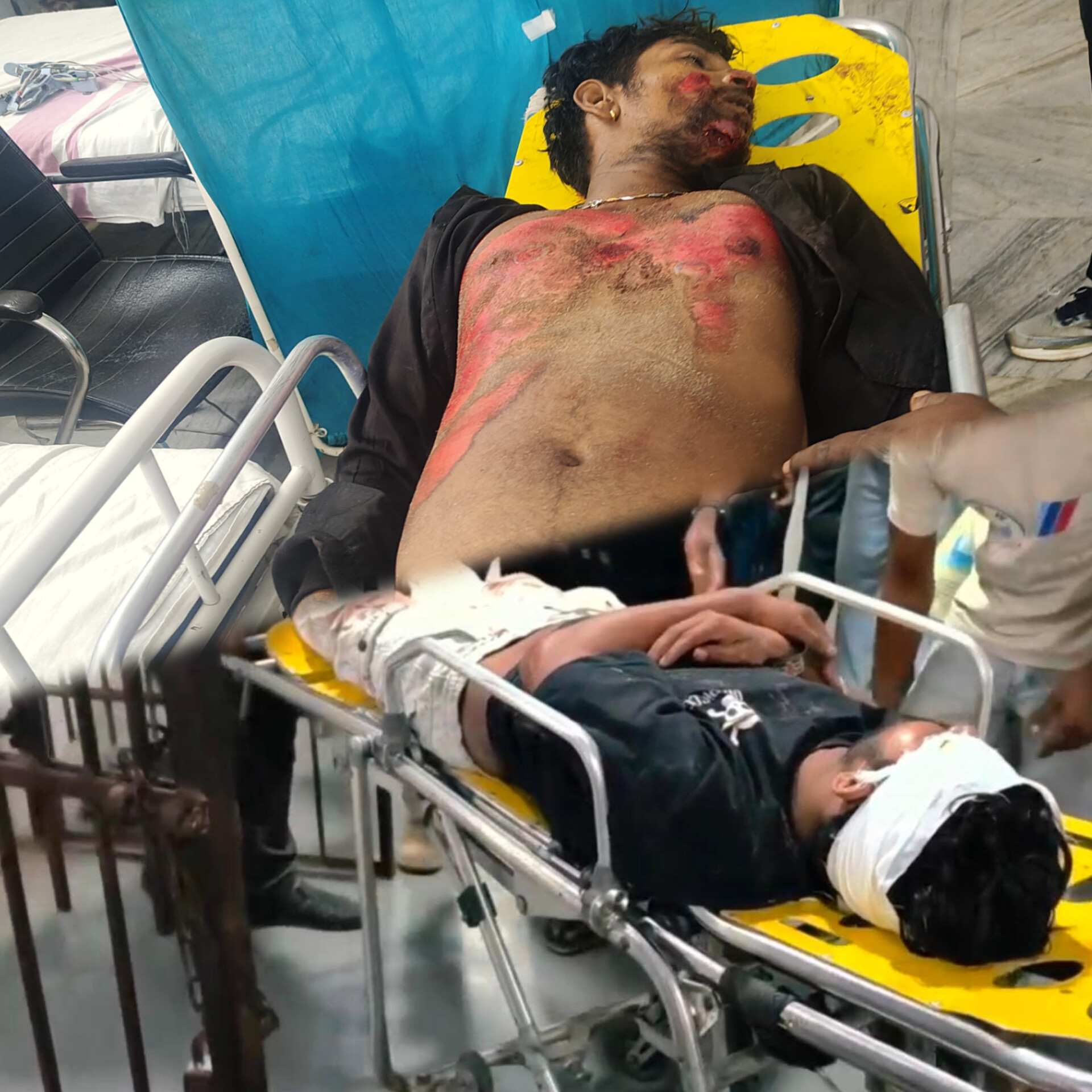 Court Escort Vehicle Collision Claims One Life, Another Critical on Puri-Konark Road